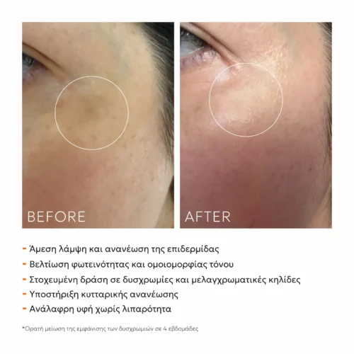 Exo Glow Face Serum 30 ml — φωτογραφίες πριν και μετά για τις δυσχρωμίες και την ομοιομορφία του τόνου της επιδερμίδας